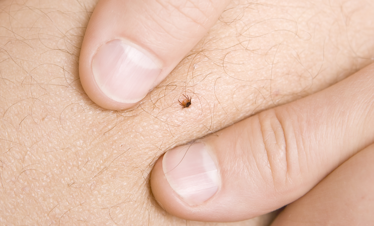 Integrale behandeling van lymeneuroborreliose